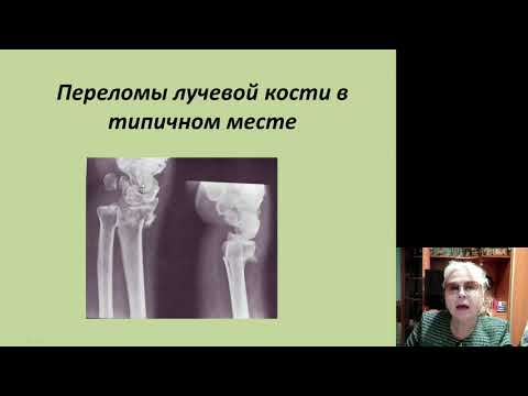 Видео: Травматология и ортопедия. Повреждения верхних конечностей