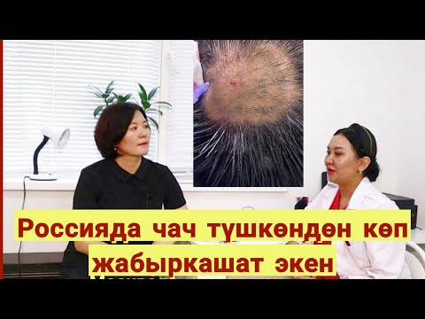 Видео: " Эркектер стресс, депрессиясын ичине катып журуп, эрте чачтары тушуп калат"#КумараСатарова
