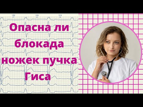 Видео: Опасна ли блокада ножек пучка Гиса.