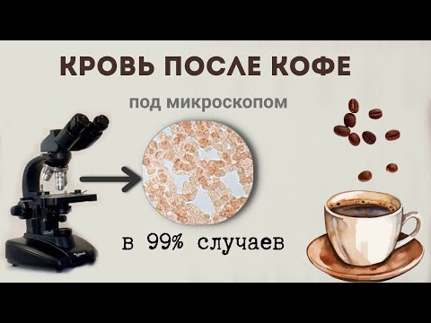 Видео: Как употребление кофе чаще всего влияет на кровь.