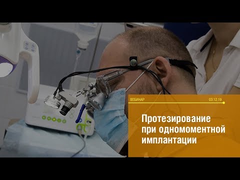 Видео: 03.12.2019. Вебинар Камиля Хабиева "Протезирование при одномоментной имплантации».