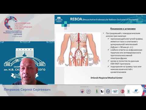 Видео: Тяжелая сочетанная травма Петриков С.С.