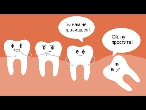 Видео: Зачем нужны зубы мудрости? Нужно ли удалять зуб мудрости? Вся правда о зубе мудрости.