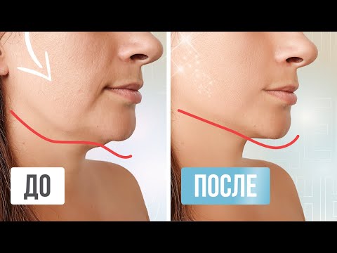 Видео: Убираем ОБВИСШИЕ ЩЕКИ за 10 МИНУТ | Простые упражнения для поднятия щек в домашних условиях