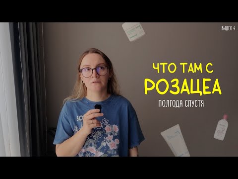 Видео: Розацеа: полгода спустя. Что изменилось?