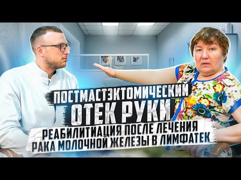 Видео: Постмастэктомический отек руки. Реабилитация после лечения рака молочной железы в Лимфатек.