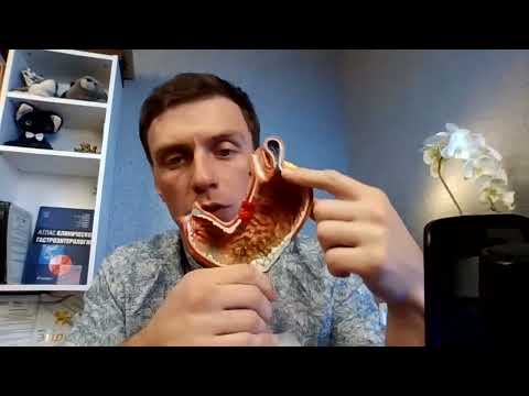 Видео: Живое общение. СРК. Раздраженный кишечник. СИБР. Бактериальный рост. Атрофический гастрит.