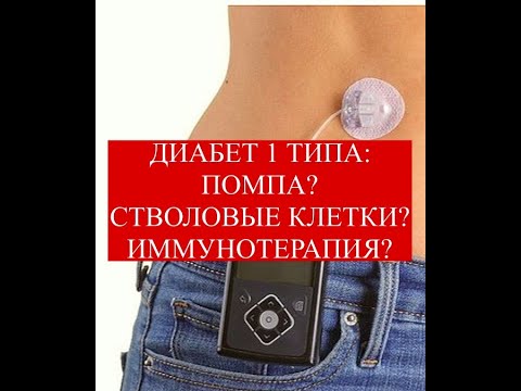 Видео: Диабет 1 типа: помпа, стволовые клетки, иммунотерапия #диабет1типа #лечениедиабета #стволовыеклетки