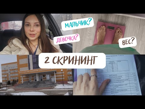 Видео: 2 СКРИНИНГ🤰🏼УЗНАЛА ПОЛ РЕБЁНКА🥳СЮРПРИЗ МУЖУ | ДНЕВНИК БЕРЕМЕННОСТИ