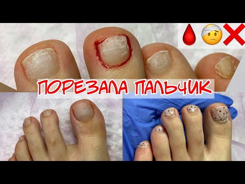 Видео: Педикюр самой себе 🤕 Порезала пальчик ❣ Ошибки педикюра