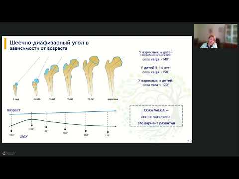 Видео: Тазобедренные суставы детей от 5 лет  Норма и патология  Принципы формирования протоколов
