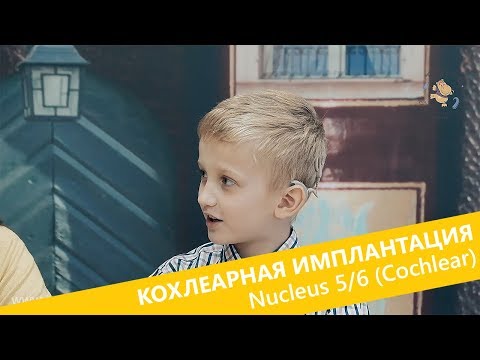 Видео: Эксплуатация звуковых процессоров Nucleus 5 и Nucleus 6 систем кохлеарной имплантации Cochlear