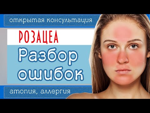 Видео: 129| РОЗАЦЕА 6. Не повторяйте чужие ошибки (эти мази под запретом)! План действий при ДЕРМАТИТЕ.