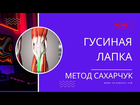 Видео: Гусиная лапка и другие боли в колене