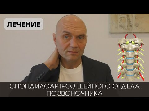 Видео: СПОНДИЛОАРТРОЗ ШЕЙНОГО ОТДЕЛА ПОЗВОНОЧНИКА. ЛЕЧЕНИЕ
