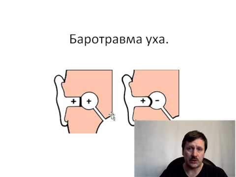 Видео: Способы выравнивания давления в полости уха. Продувка.
