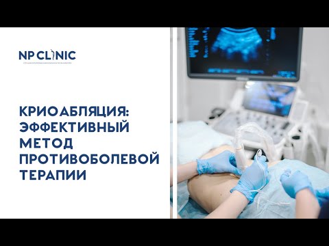 Видео: Криоабляция: эффективный метод противоболевой терапии