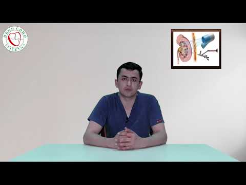 Видео: САНГШИКАНИИ БЕРУНАНДОМИИ САНГИ ГУРДА ДАР БЕМОРИСТОНИ ИБНИ СИНО