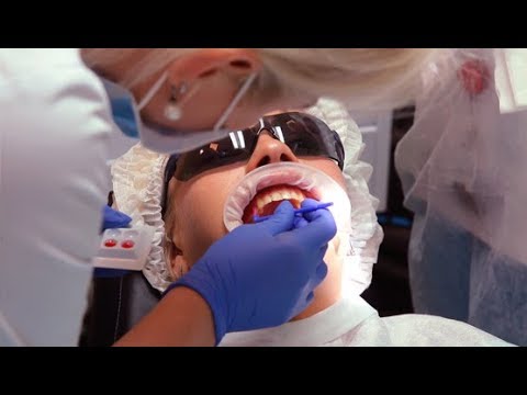 Видео: Профессиональная чистка зубов | Все этапы |AirFlow | Видео процедуры