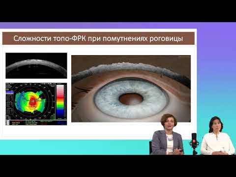 Видео: Лазерная коррекция зрения и герпес: взгляд терапевта и хирурга