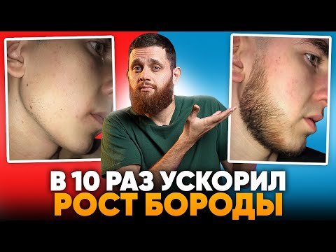 Видео: Ускорил рост бороды в 10 раз С НУЛЯ / Результаты ксиноксина