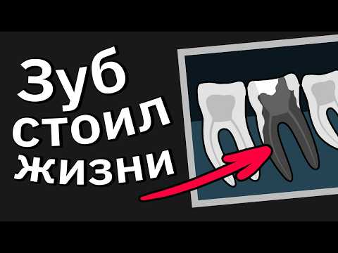 Видео: Врачи Сливают Моменты "Чёрт, Всё Намного Хуже, Чем Я Думал"