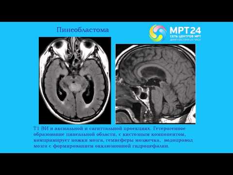 Видео: Фрайтер МР-визуализация патологий эндокринной системы