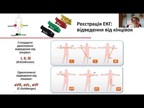 Видео: Майстер-клас: "Правила розшифрування ЕКГ при найбільш розповсюджених порушеннях серцевого ритму"