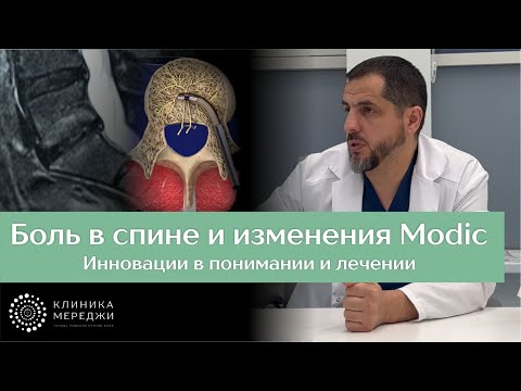 Видео: Новый источник боли: Базивертебральный нерв и эндплейтогенная боль в спине. Изменения Модик.