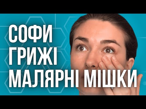 Видео: Суфи, Малярні мішки та Грижі під очима — що робити?