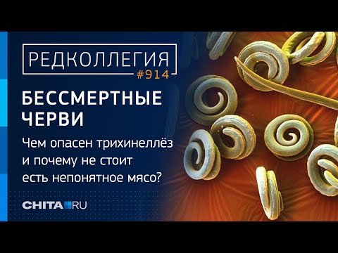Видео: Шашлык с червями: как медвежатина отправила в больницу четыре семьи из Забайкалья?