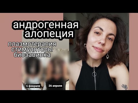 Видео: Андрогенная алопеция | прошла курс плазмотерапии | неоптид дюкрей не помог | сделала биозавивку