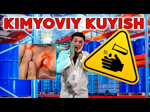 Видео: Kimyoviy kuyish (18 savol) Кимёвий куйиш
