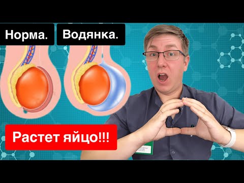 Видео: Водянка яичка!!! Гидроцеле! Из за чего возникает и как лечится!