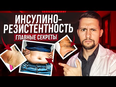 Видео: Инсулинорезистентность - ВСЕ, ЧТО НУЖНО ЗНАТЬ