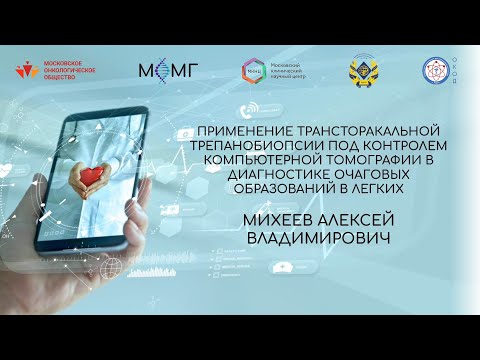 Видео: Применение трансторакальной трепанобиопсии под контролем компьютерной томографии в диагностике...