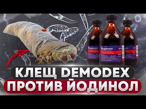 Видео: Клещ DEMODEX против Йодинол | Угревая Железница Demodex
