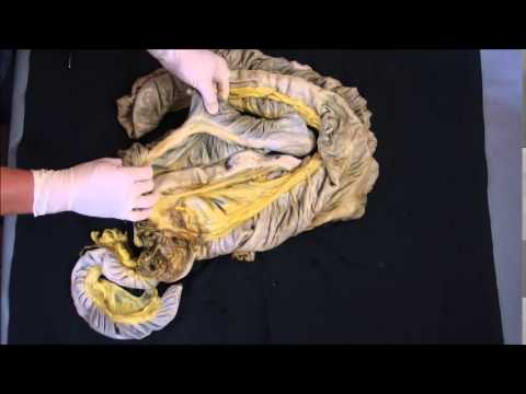 Видео: слепая кишка лошади