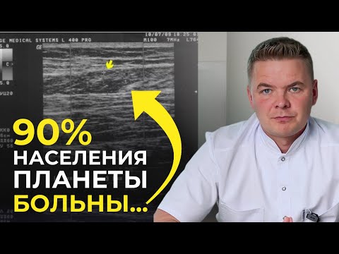 Видео: Невидимая угроза для вашего тела: триггерные точки в мышцах