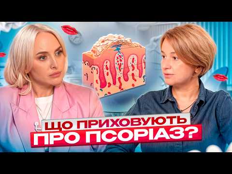 Видео: Катерина Безвершенко про стрес, харчування, психосоматику та найкращі методи лікування псоріазу