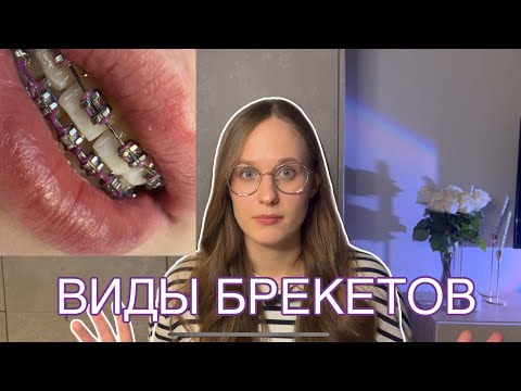 Видео: Какие брекеты лучше?