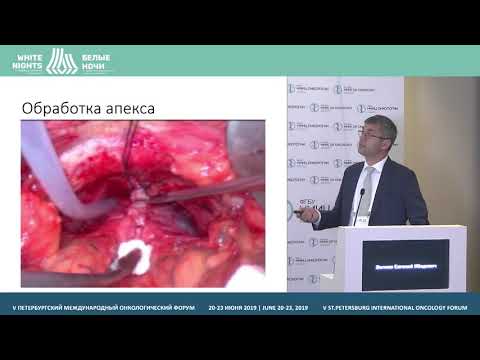 Видео: Обеспечение функциональных результатов при выполнении радикальной простатэктомии. Удержание мочи