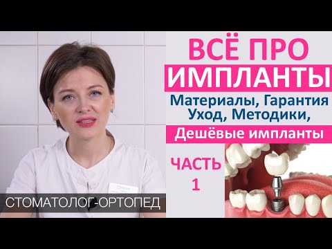 Видео: Импланты (часть 1): материалы, гарантия, цена, срок службы, одномоментная и отсроченная имплантация