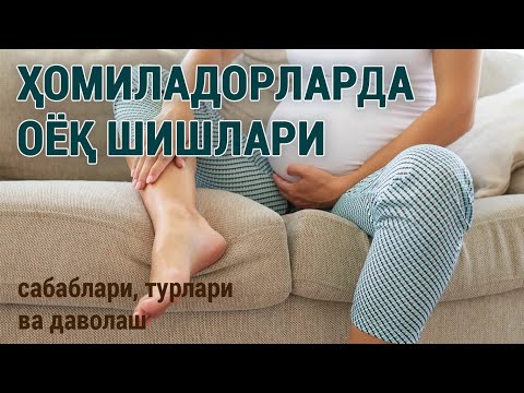 Видео: Ҳомиладорларда оёқ шишлари: сабаблари, турлари ва даволаш