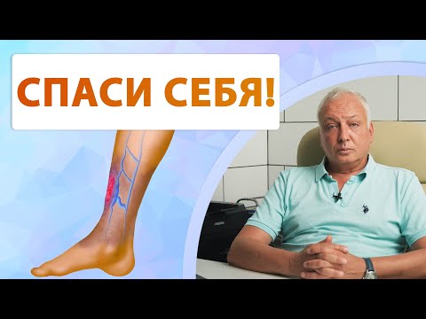 Видео: Трофическая язва