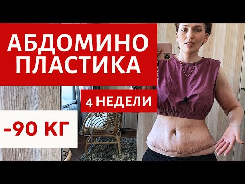 Видео: ТАКОГО Я НЕ ОЖИДАЛА! |  4 НЕДЕЛИ | ДО И ПОСЛЕ | АБДОМИНОПЛАСТИКА |  ПОДТЯЖКА ЖИВОТА И РУК