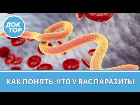 Видео: Врач-инфекционист объяснила, как понять, есть ли у вас паразиты