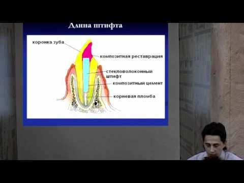 Видео: Использование стекловолоконных штифтов часть 1