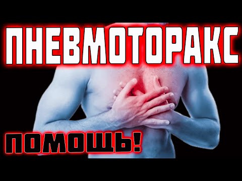 Видео: ПНЕВМОТОРАКС- ТО ЧТО ЗНАЮТ ЕДИНИЦЫ! | ПОМОЩЬ ЛЕГКОДОСТУПНЫМИ СРЕДСТВАМИ!