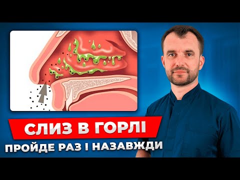 Видео: Слиз в горлі: Причини та як позбутися! Як вилікувати слиз в горлі та нежить